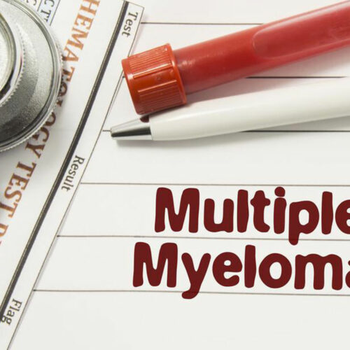 Dealing with multiple myeloma – Things you should know about