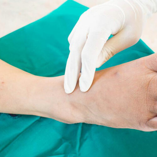 Here’s what you need to know about neuropathy symptoms and more