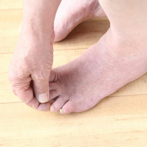 Fibromyalgia Foot Pain – Factors to Understand