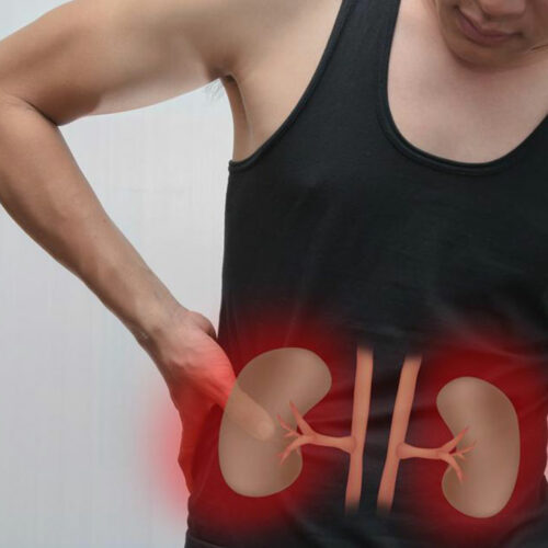 Kidney Failure – Causes and Symptoms